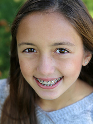 orthodontic faqs